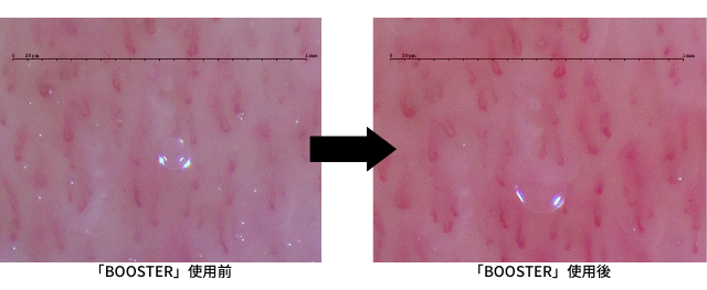 BOOSTERで血管トレーニング