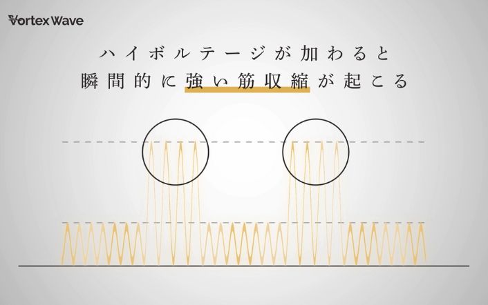 施術時間を短縮する波形「Vortex Wave」搭載