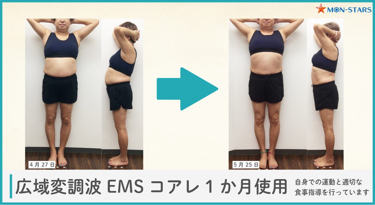 EMSトレーニングの効果：筋肉の引き締め