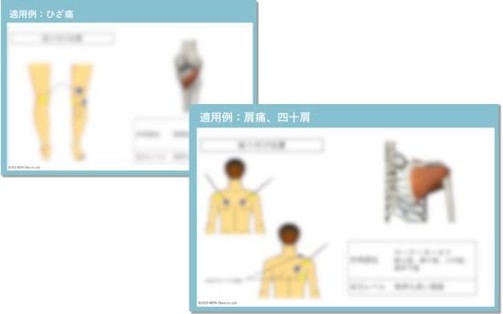 EMSパッド貼り方ガイド