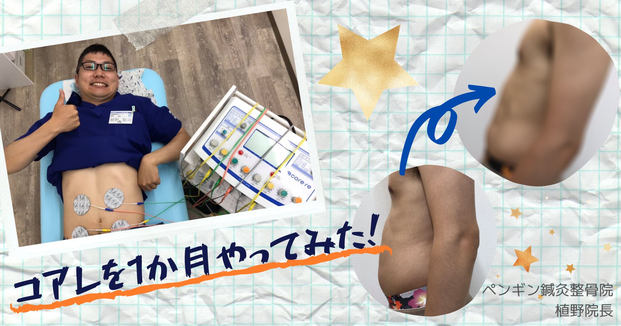 EMSコアレって効果あるの？実際に1か月試してみた結果【体験レポート】/ペンギン鍼灸整骨院(神奈川県)